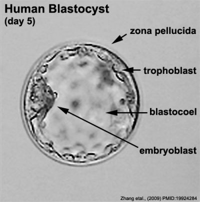 400px-human_embryo_day_5_label